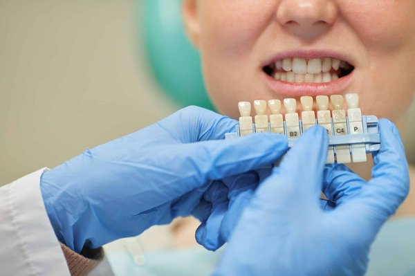 Comment les centres de denturologie gèrent-ils les réparations de prothèses ?